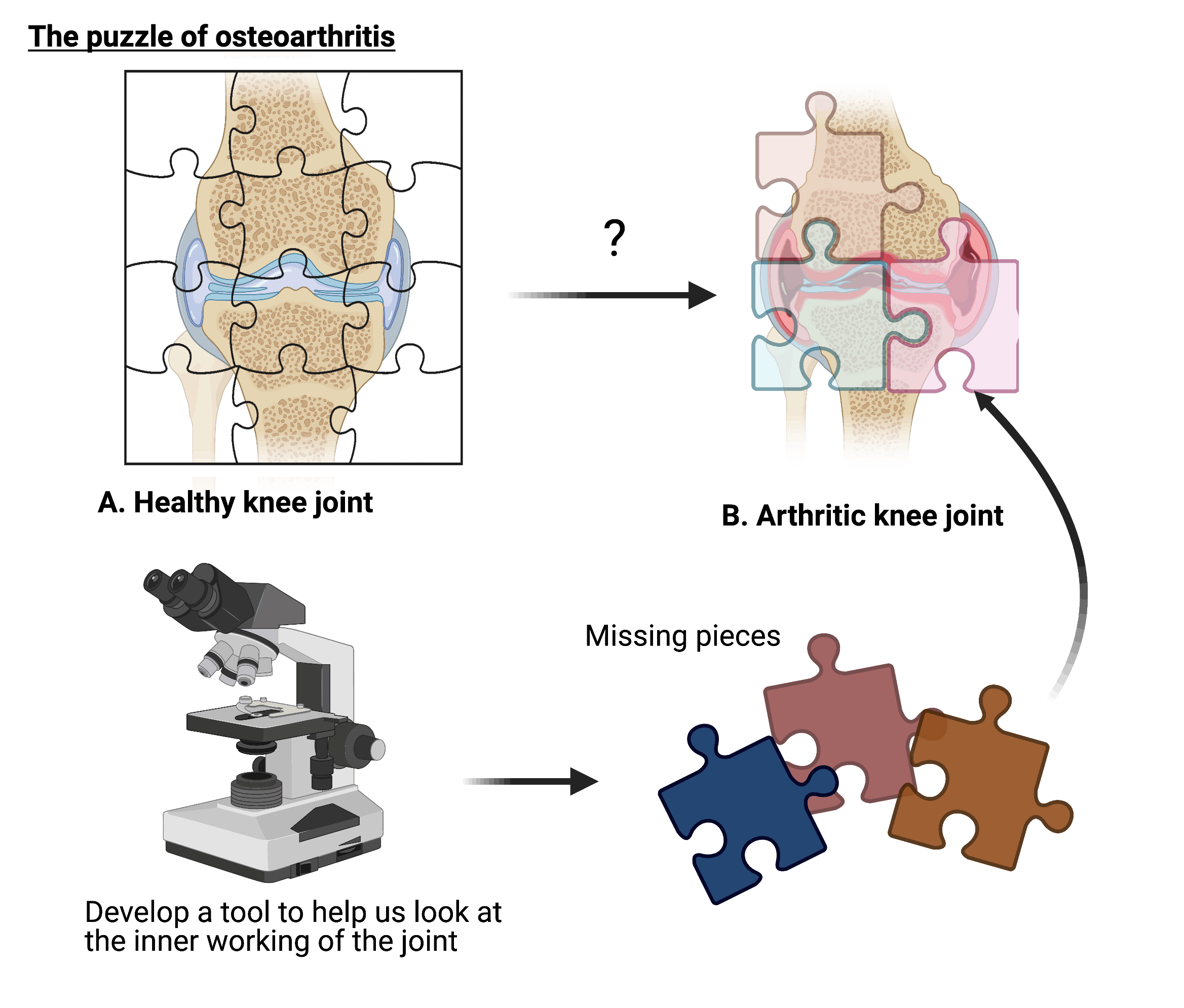 The diagram shows osteoarthritis and the puzzle of a healthy knee joint vs an arthritic knee joint