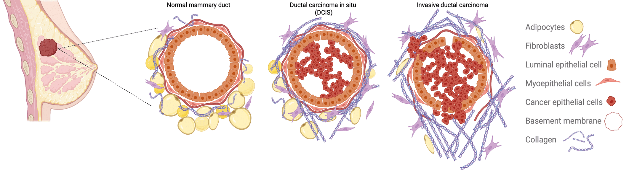 Cancer Cells Adjust Their Velcro To Enhance Their Spread