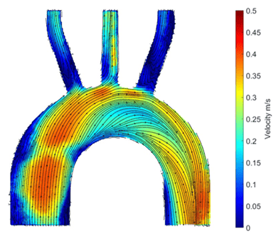 Figure 2: Image of particle image velocimetry results showing the velocity values of the flow in the phantom. 